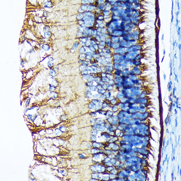 Immunohistochemistry - Anti-CRALBP Antibody [ARC1502] (A307741) - Antibodies.com