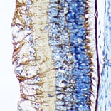 Immunohistochemistry - Anti-CRALBP Antibody [ARC1502] (A307741) - Antibodies.com