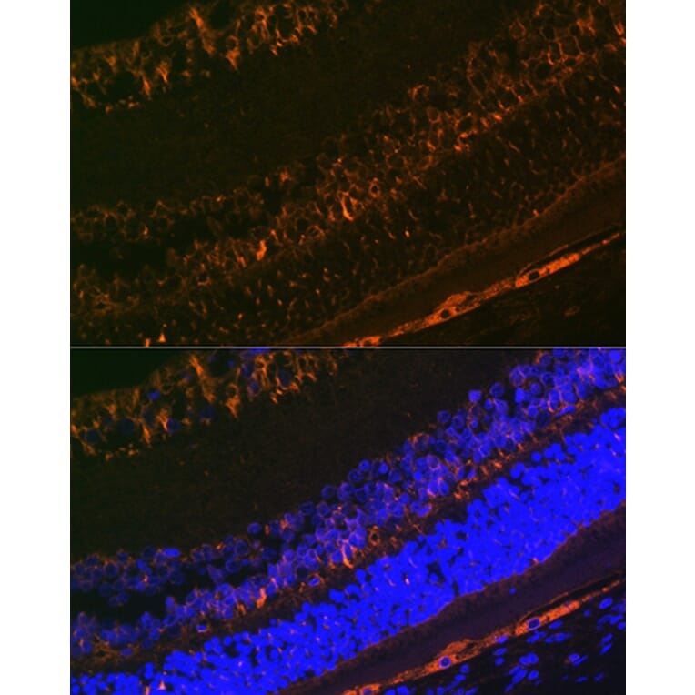 Immunofluorescence - Anti-CRALBP Antibody [ARC1502] (A307741) - Antibodies.com
