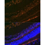 Immunofluorescence - Anti-CRALBP Antibody [ARC1502] (A307741) - Antibodies.com
