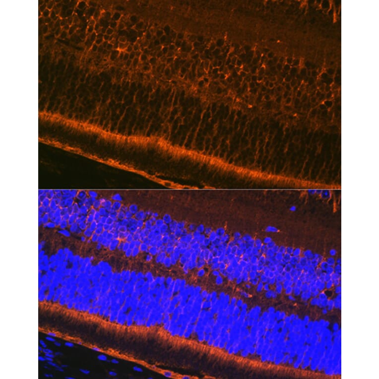 Immunofluorescence - Anti-CRALBP Antibody [ARC1502] (A307741) - Antibodies.com