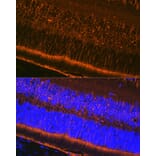 Immunofluorescence - Anti-CRALBP Antibody [ARC1502] (A307741) - Antibodies.com