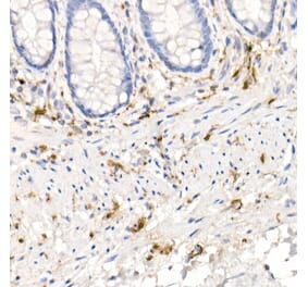Western Blot - Anti-S100 beta Antibody [ARC50351] (A307742) - Antibodies.com