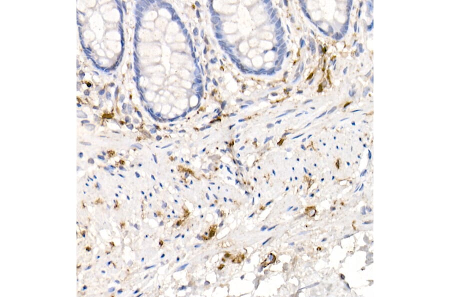 Western Blot - Anti-S100 beta Antibody [ARC50351] (A307742) - Antibodies.com