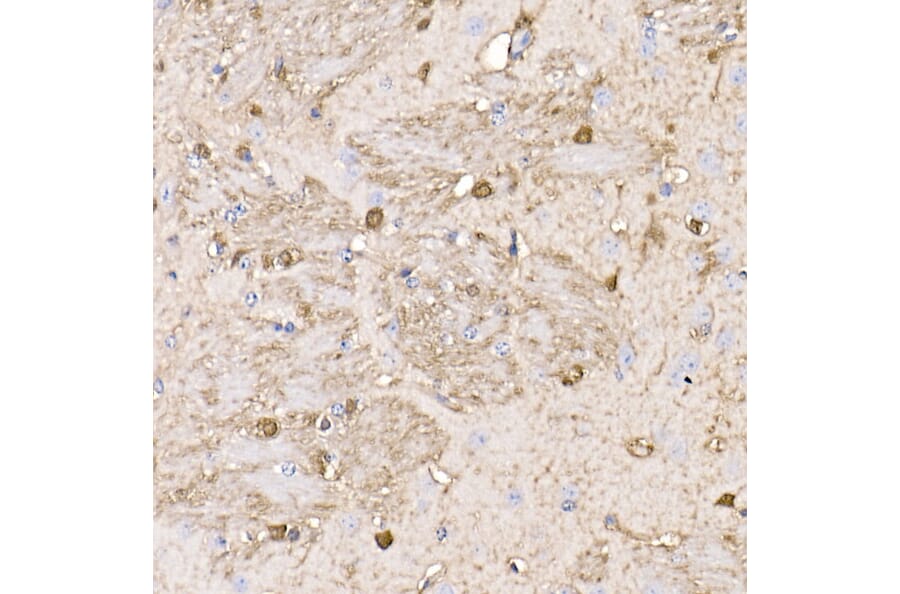 Western Blot - Anti-S100 beta Antibody [ARC50351] (A307742) - Antibodies.com