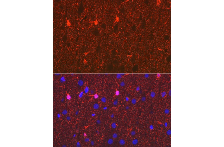 Immunohistochemistry - Anti-S100 beta Antibody [ARC50351] (A307742) - Antibodies.com