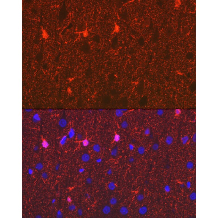 Immunohistochemistry - Anti-S100 beta Antibody [ARC50351] (A307742) - Antibodies.com