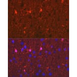 Immunohistochemistry - Anti-S100 beta Antibody [ARC50351] (A307742) - Antibodies.com