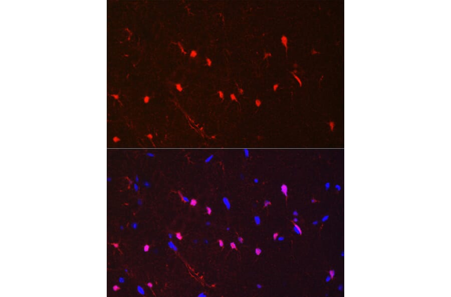 IHC of mouse brain stained with rabbit anti-S100 beta antibody [ARC50351] (A307742)
