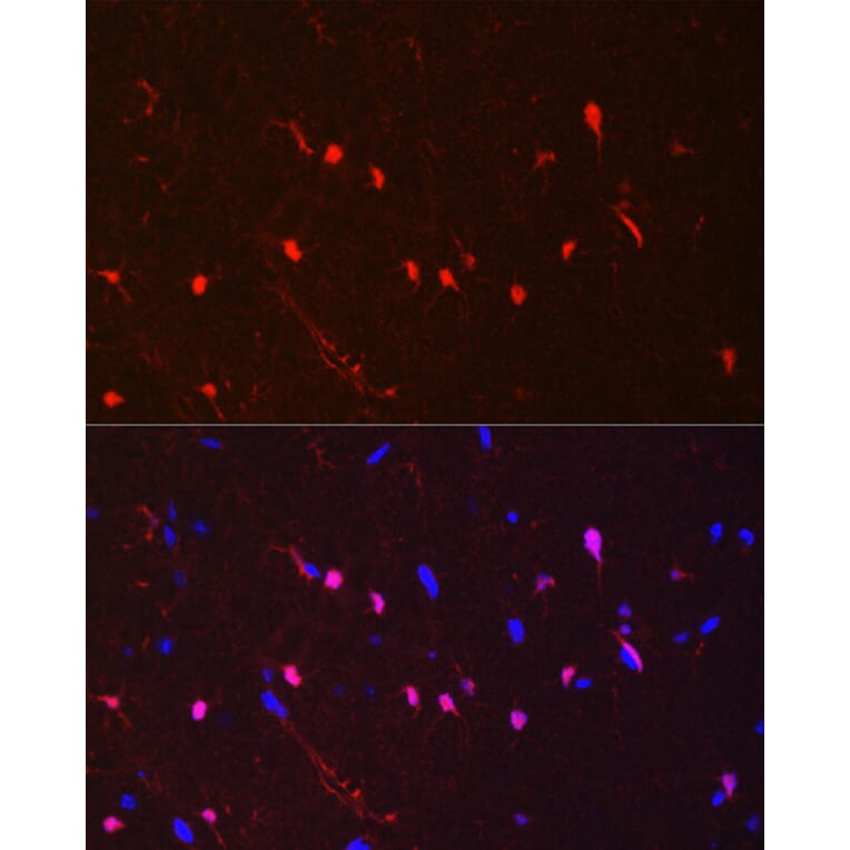 Immunohistochemistry - Anti-S100 beta Antibody [ARC50351] (A307742) - Antibodies.com