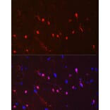 Immunohistochemistry - Anti-S100 beta Antibody [ARC50351] (A307742) - Antibodies.com