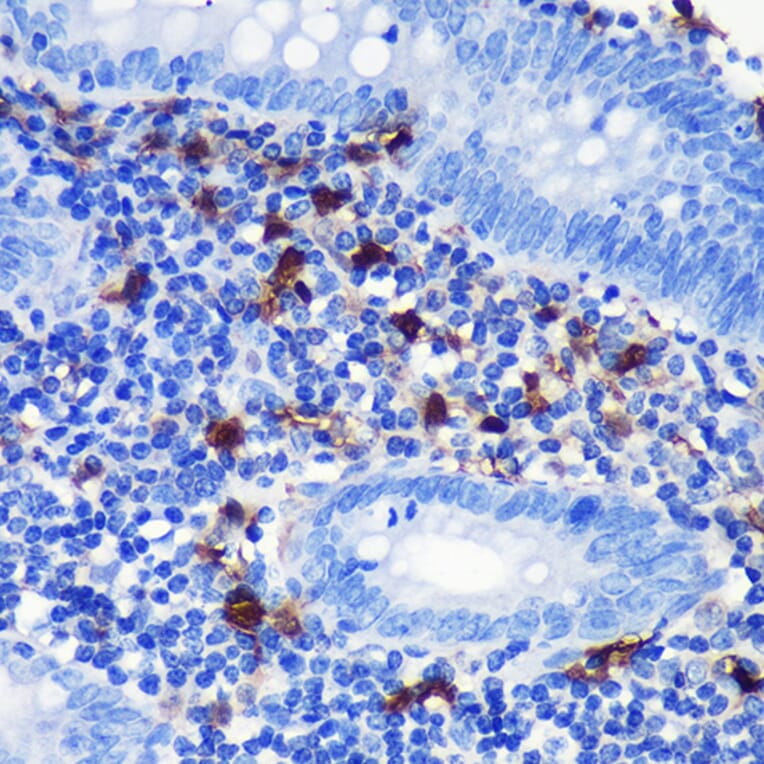 Immunofluorescence - Anti-S100 beta Antibody (A307742) - Antibodies.com