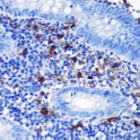 Immunofluorescence - Anti-S100 beta Antibody (A307742) - Antibodies.com