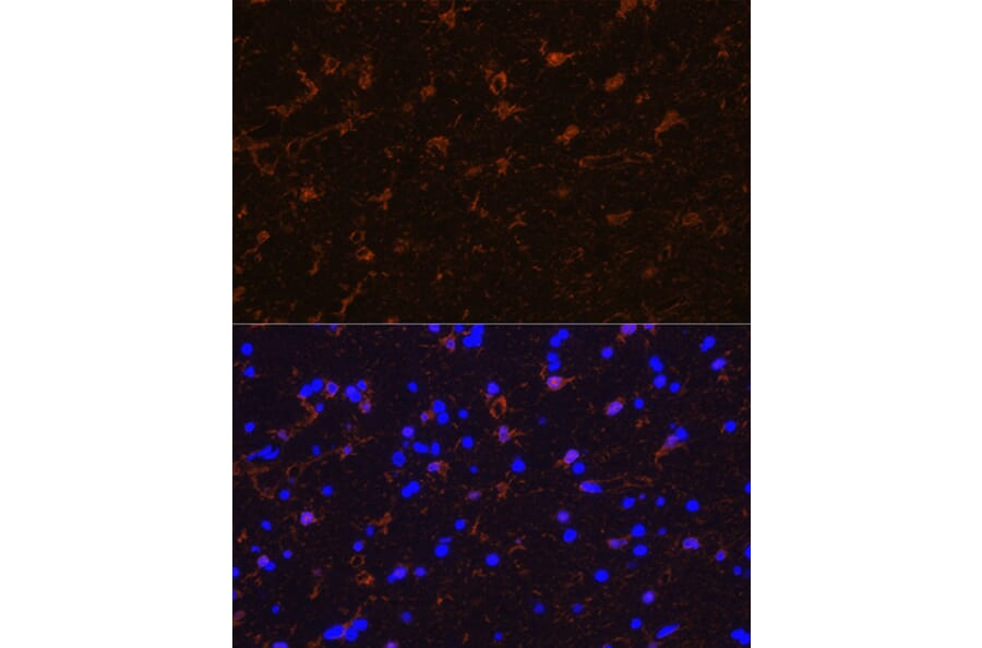 Immunofluorescence - Anti-S100 beta Antibody (A307742) - Antibodies.com