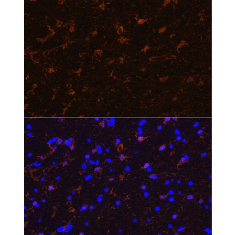 Immunofluorescence - Anti-S100 beta Antibody (A307742) - Antibodies.com