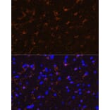 Immunofluorescence - Anti-S100 beta Antibody (A307742) - Antibodies.com