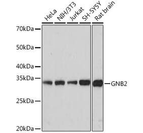 Western Blot - Anti-GNB2 Antibody [ARC1675] (A307743) - Antibodies.com