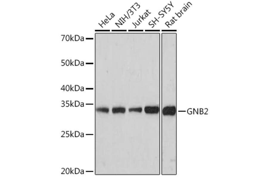 Western Blot - Anti-GNB2 Antibody [ARC1675] (A307743) - Antibodies.com