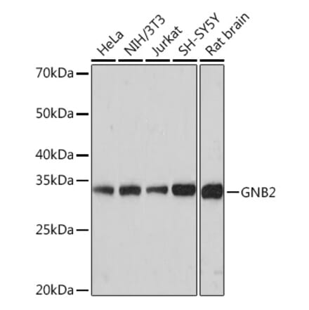 Western Blot - Anti-GNB2 Antibody [ARC1675] (A307743) - Antibodies.com