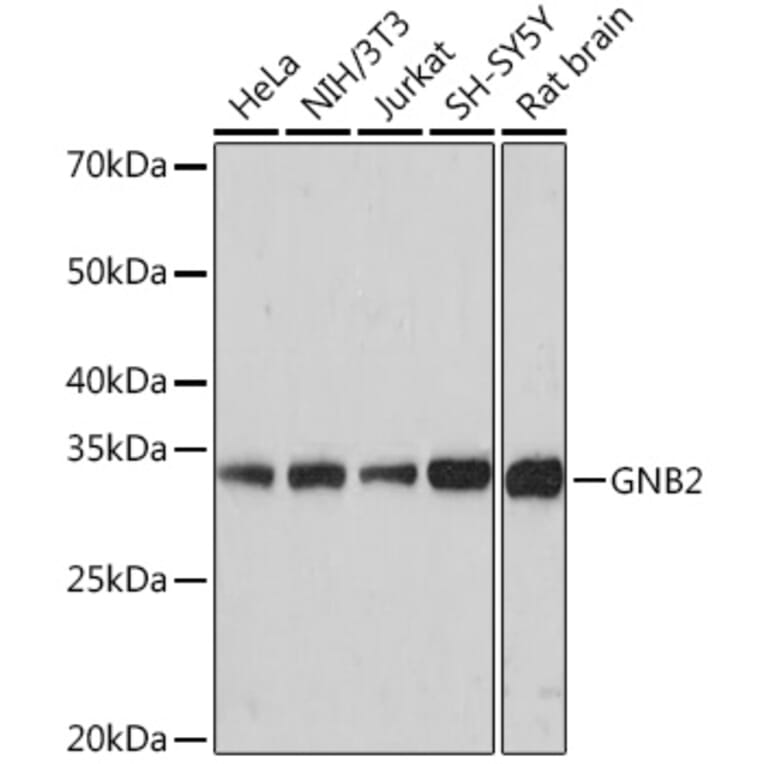 Western Blot - Anti-GNB2 Antibody [ARC1675] (A307743) - Antibodies.com