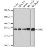 Western Blot - Anti-GNB2 Antibody [ARC1675] (A307743) - Antibodies.com