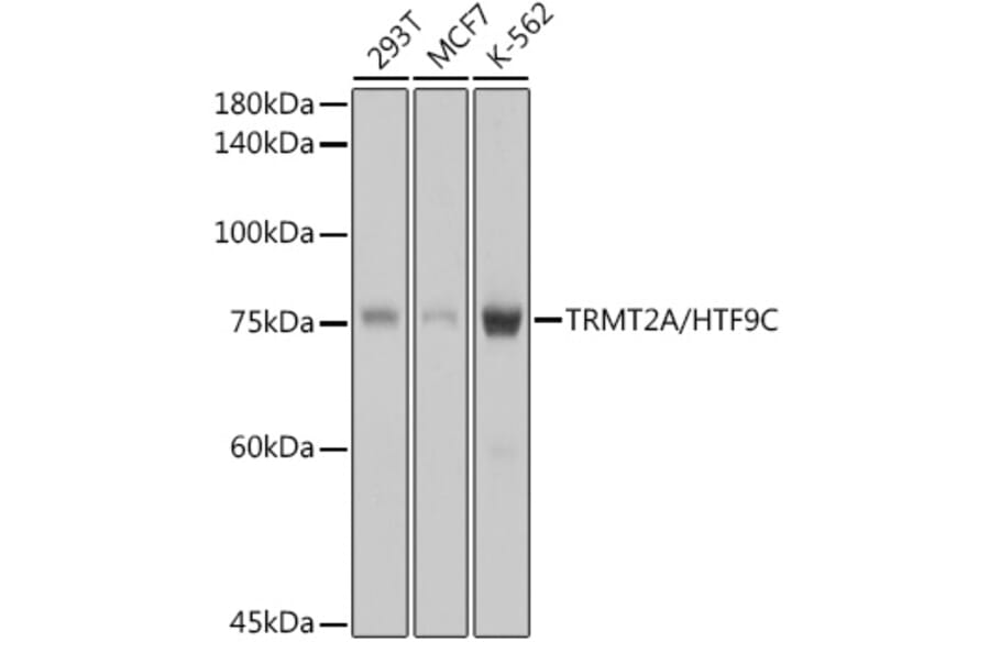 Western Blot - Anti-HTF9C/TRMT2A Antibody [ARC2498] (A307744) - Antibodies.com