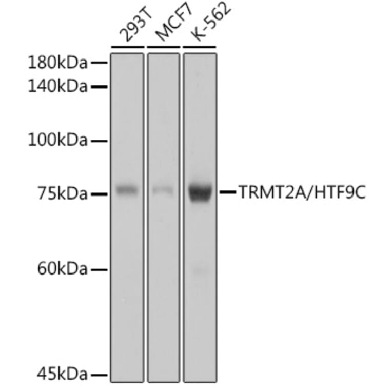 Western Blot - Anti-HTF9C/TRMT2A Antibody [ARC2498] (A307744) - Antibodies.com