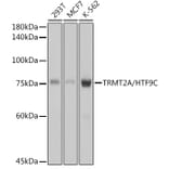 Western Blot - Anti-HTF9C/TRMT2A Antibody [ARC2498] (A307744) - Antibodies.com