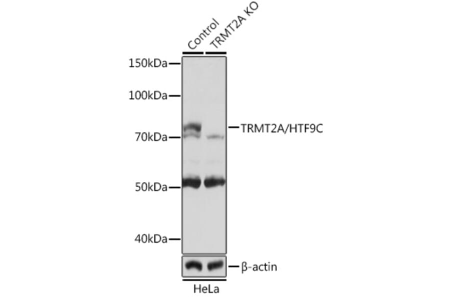 Western Blot - Anti-HTF9C / TRMT2A Antibody (A307745) - Antibodies.com