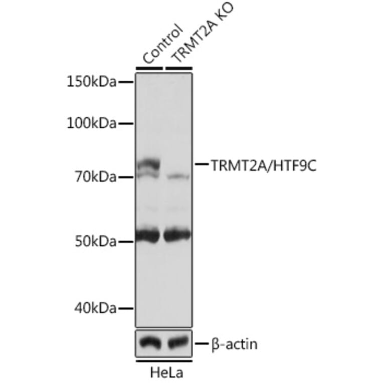 Western Blot - Anti-HTF9C / TRMT2A Antibody (A307745) - Antibodies.com