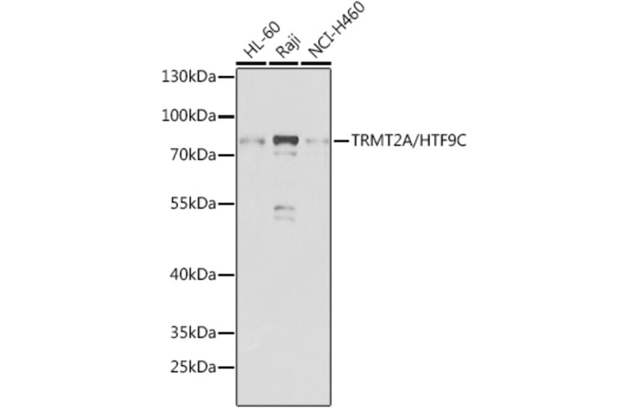 Western Blot - Anti-HTF9C/TRMT2A Antibody (A307746) - Antibodies.com