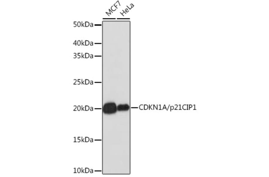 Western Blot - Anti-p21 Antibody [ARC51040] (A307748) - Antibodies.com