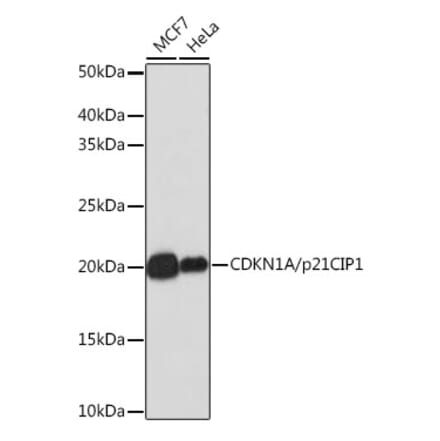 Western Blot - Anti-p21 Antibody [ARC51040] (A307748) - Antibodies.com