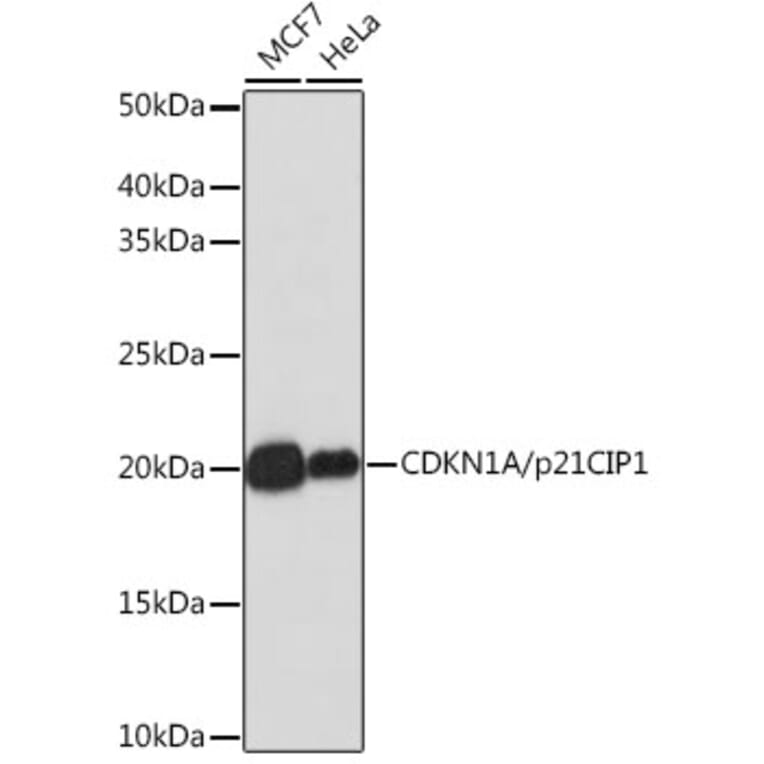 Western Blot - Anti-p21 Antibody [ARC51040] (A307748) - Antibodies.com