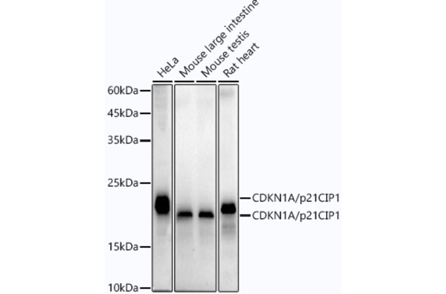 Western Blot - Anti-p21 Antibody [ARC51040] (A307748) - Antibodies.com