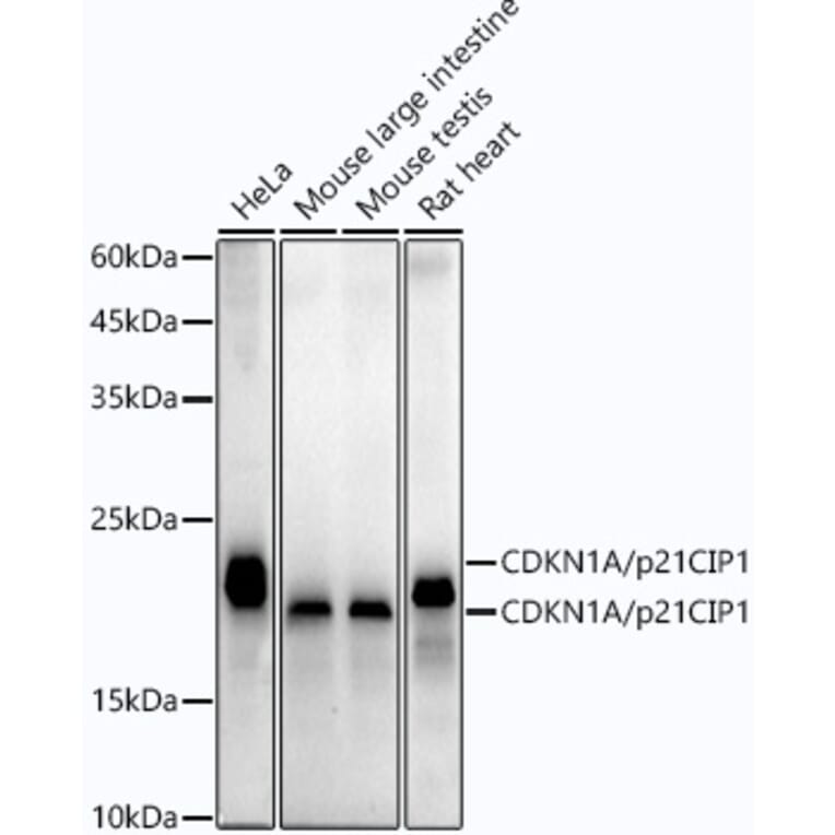 Western Blot - Anti-p21 Antibody [ARC51040] (A307748) - Antibodies.com