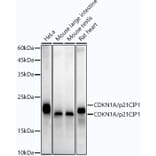 Western Blot - Anti-p21 Antibody [ARC51040] (A307748) - Antibodies.com