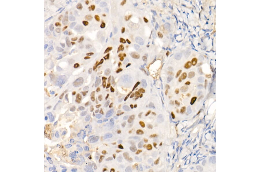 Immunohistochemistry - Anti-p21 Antibody [ARC51040] (A307748) - Antibodies.com