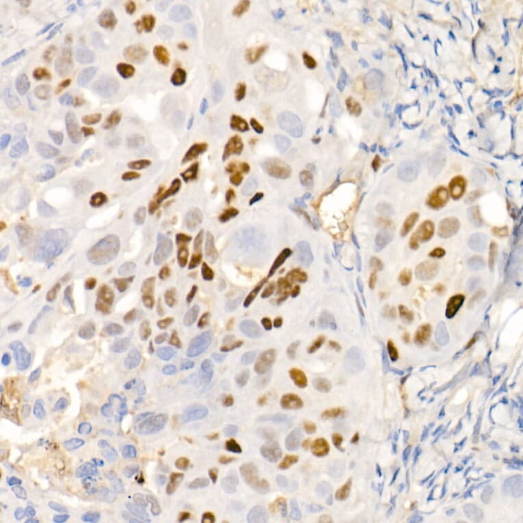 Immunohistochemistry - Anti-p21 Antibody [ARC51040] (A307748) - Antibodies.com