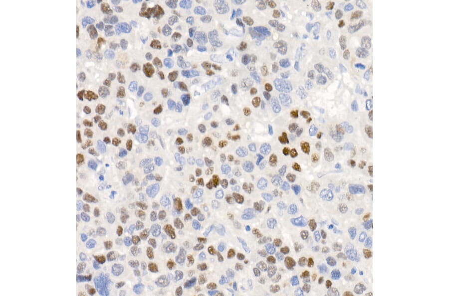 Immunohistochemistry - Anti-p21 Antibody [ARC51040] (A307748) - Antibodies.com