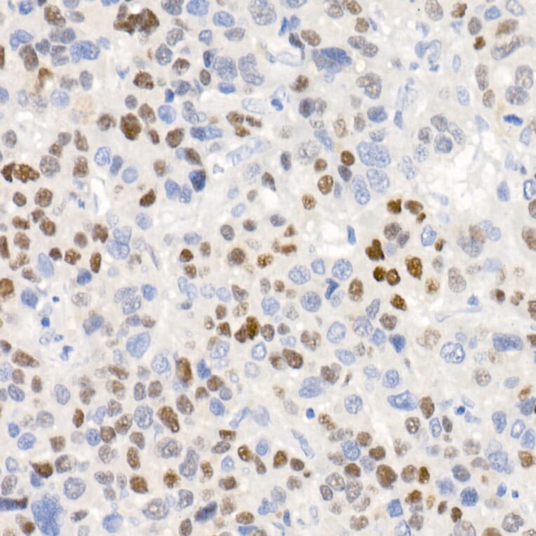 Immunohistochemistry - Anti-p21 Antibody [ARC51040] (A307748) - Antibodies.com