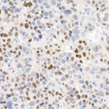 Immunohistochemistry - Anti-p21 Antibody [ARC51040] (A307748) - Antibodies.com