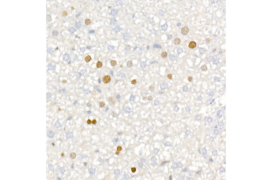 Immunohistochemistry - Anti-p21 Antibody [ARC51040] (A307748) - Antibodies.com