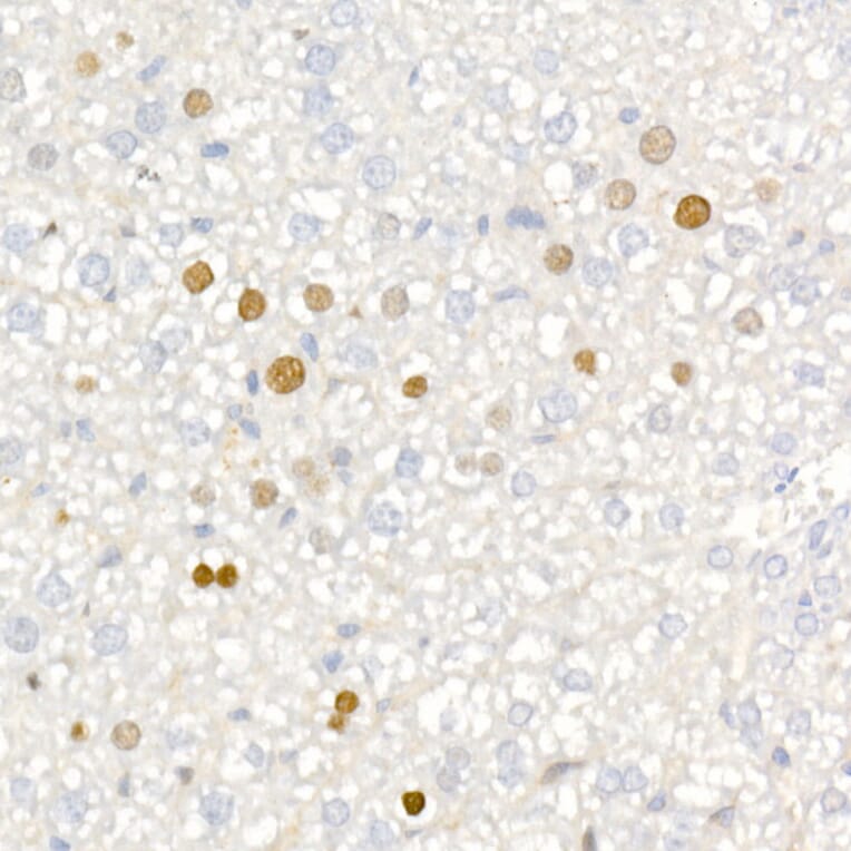Immunohistochemistry - Anti-p21 Antibody [ARC51040] (A307748) - Antibodies.com