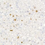 Immunohistochemistry - Anti-p21 Antibody [ARC51040] (A307748) - Antibodies.com