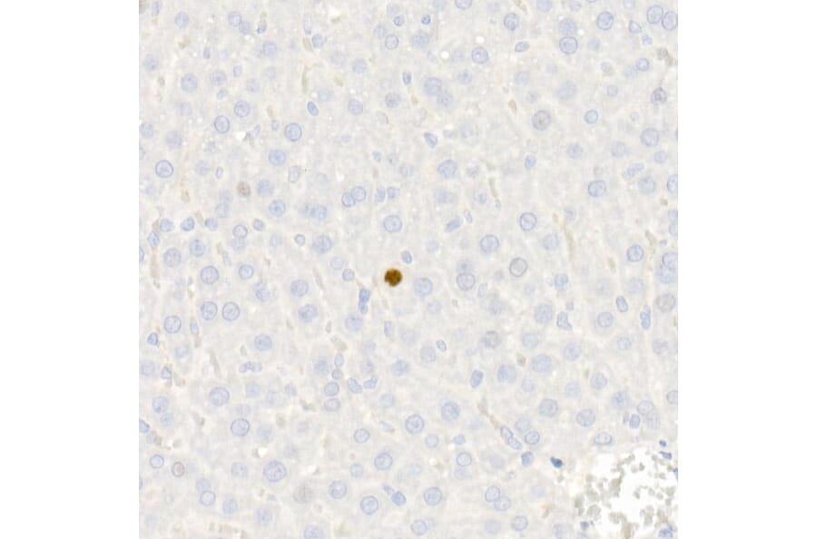 Immunohistochemistry - Anti-p21 Antibody [ARC51040] (A307748) - Antibodies.com