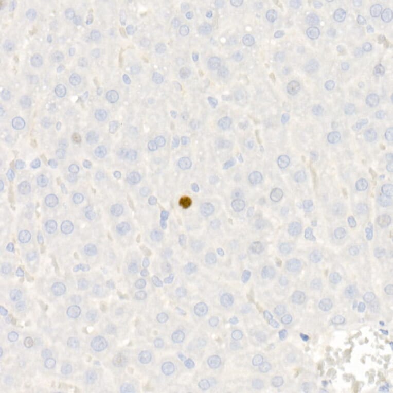 Immunohistochemistry - Anti-p21 Antibody [ARC51040] (A307748) - Antibodies.com