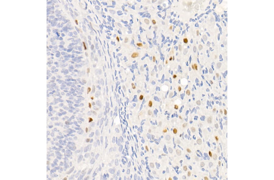 Immunohistochemistry - Anti-p21 Antibody [ARC51040] (A307748) - Antibodies.com