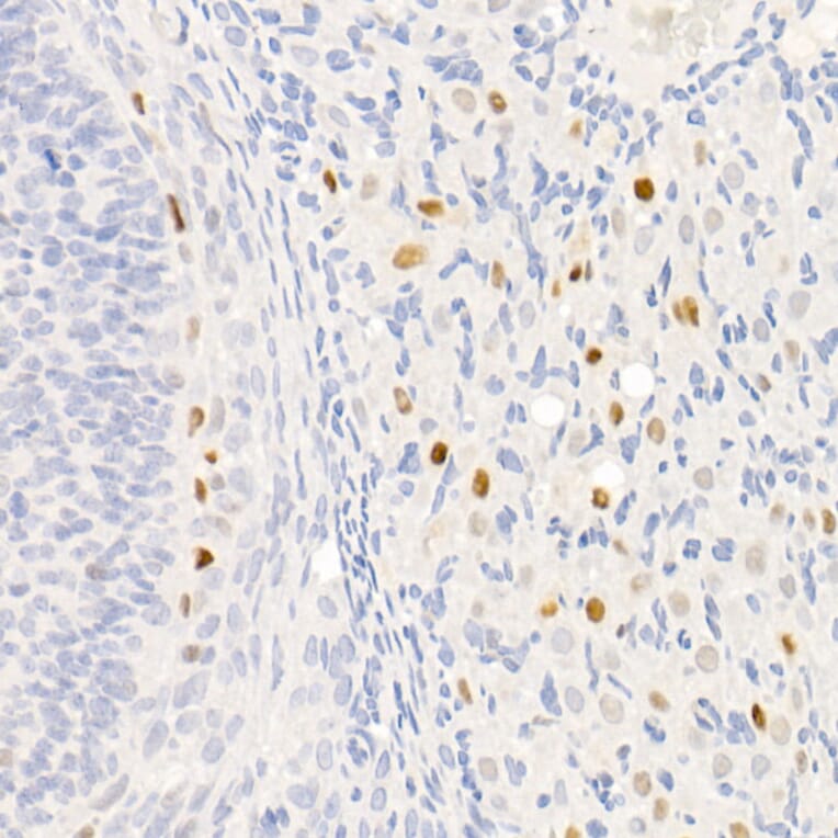 Immunohistochemistry - Anti-p21 Antibody [ARC51040] (A307748) - Antibodies.com