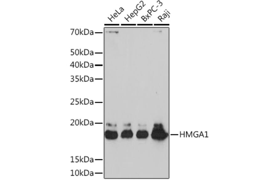 Western Blot - Anti-HMGA1 Antibody [ARC1060] (A307749) - Antibodies.com